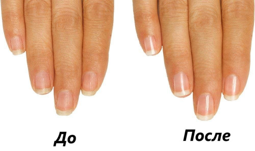 Увлажняющая маска для ногтей 5 MINUTE MANI